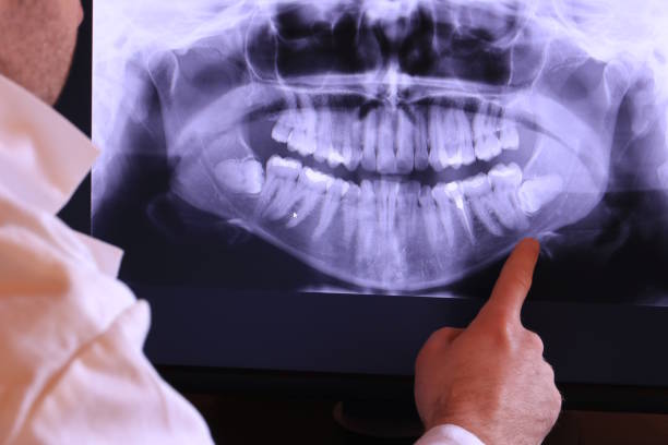 Best Emergency Dental Surgery in Charenton, LA