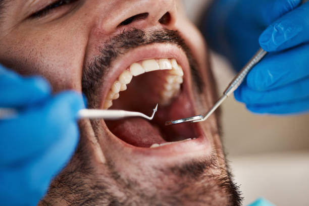 Best Pediatric Emergency Dentist in Charenton, LA